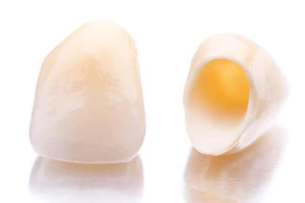 Dental crowns and caps hawthorn