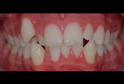 crowding treatment melbourne hawthorn